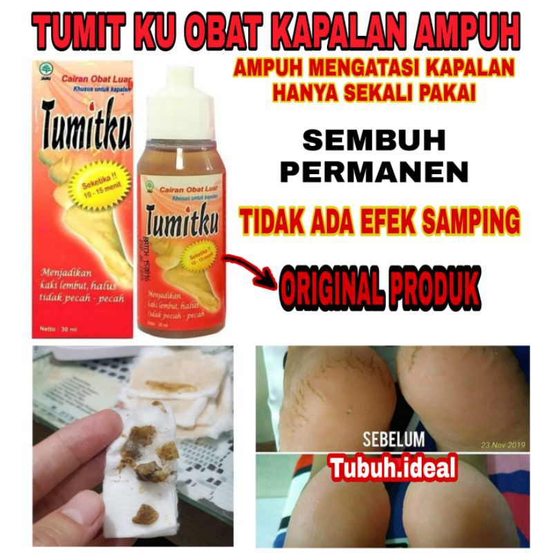 TUMITKU 30ml ORIGINAL OBAT HERBAL PENGHALUS TUMIT AMPUH