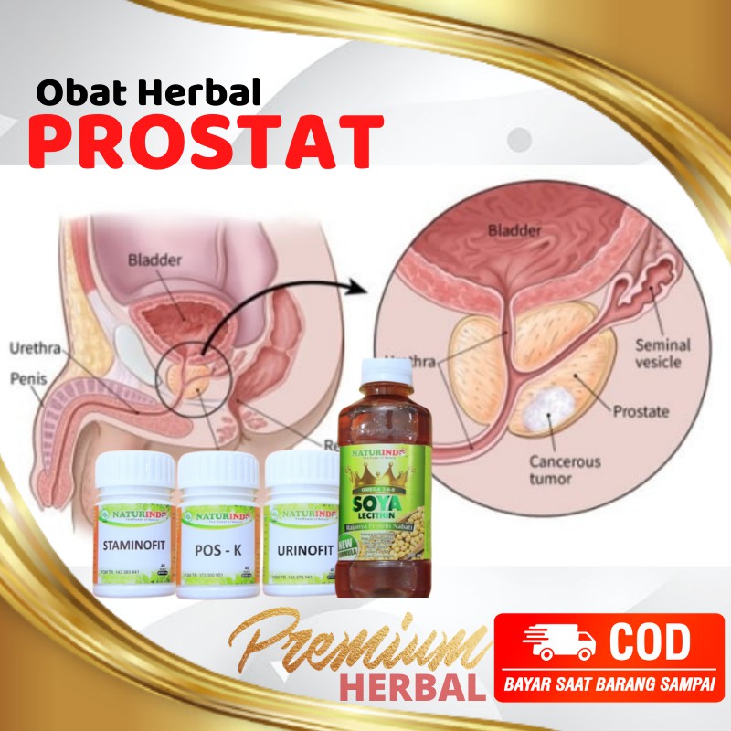 Obat Herbal Kanker Prostat Paling Ampuh Bisa Cod Shopee Indonesia