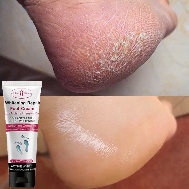 obat kaki pecah dan kering krim kaki pecah dan kering Foot mask Foot Cream Obat Kaki Pecah Dan Kering Masker kaki pengelupas kulit mati Enghalus tumit kasar 100ML Bahan susu alami / Bergizi dan melembabkan / Menghilangkan kulit mati dari kaki