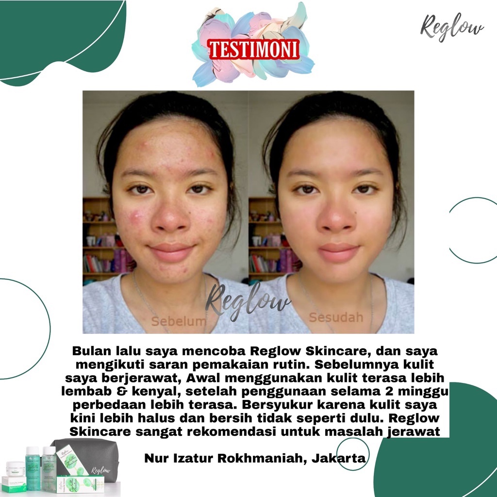 REGLOW Skincare Original Glow Skin Treatment BPOM Re Glow Series Penghilang Flek Hitam Paket Whitening Pemutih Perawatan Wajah Glowing Beauty Cream Toner Facial Wash Rglow Reg Reglow dr Shindy Putri Official Store-4