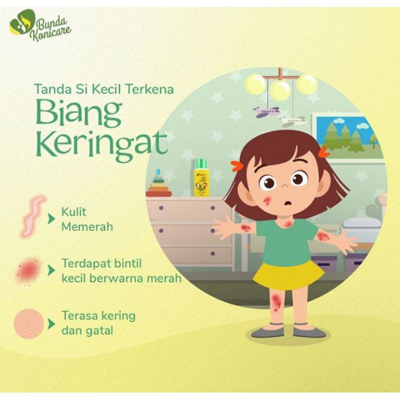 Konicare bedak biang keringat 80 gram/ biang keringat/ gangguan kulit