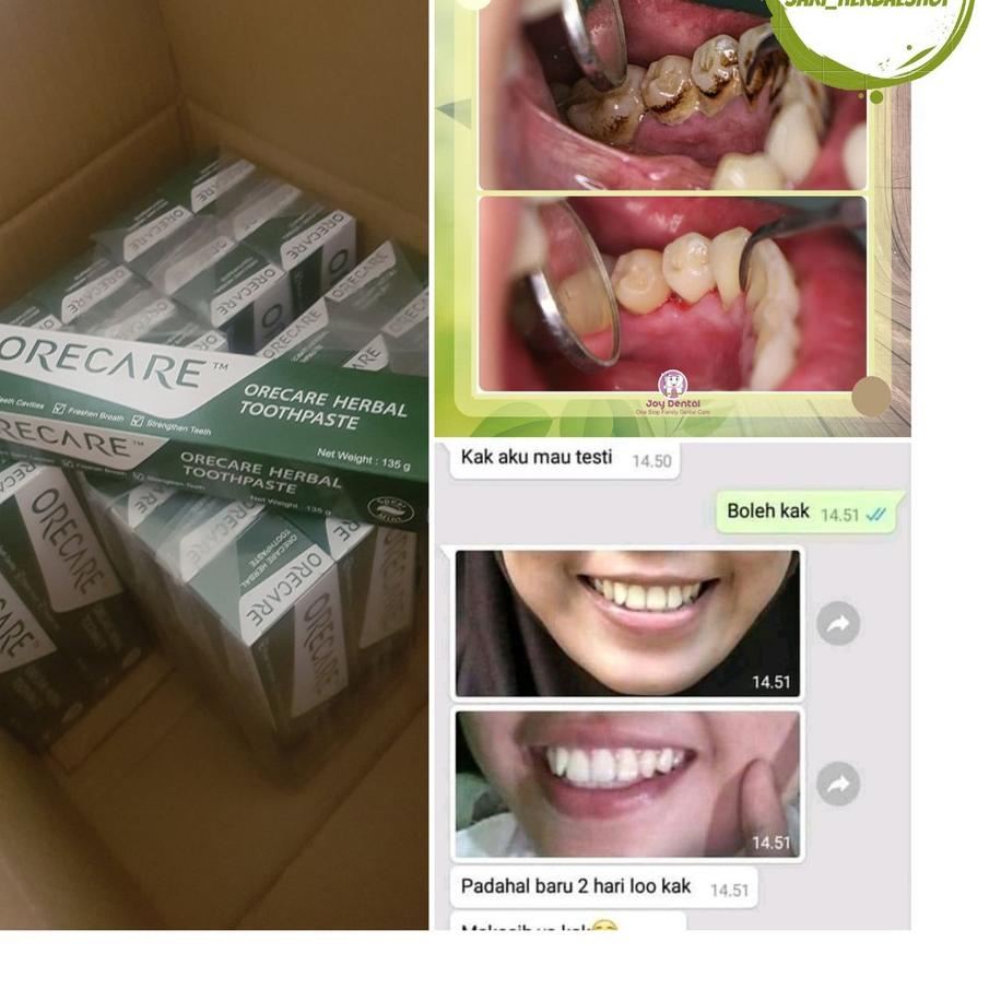 ✮✯[RESTOCK]✔️ Tiens Herbal Toothpaste Orecare Odol Alami Pemutih Mulut Termurah Original Pasta Gigi Bebas Karang ♤♧