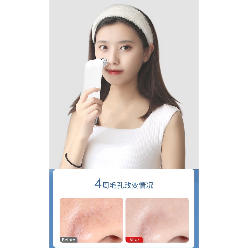 DOCO BH003 - Ultra-Micro Bubble Pore Vacuum Cleansing Instrument