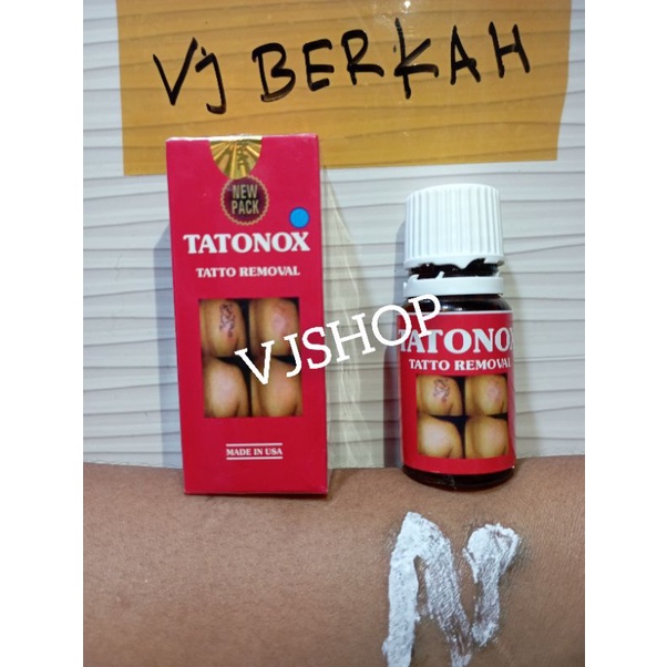 Obat Penghilang TATO Asli paling ampuh menghapus tato secara permanen