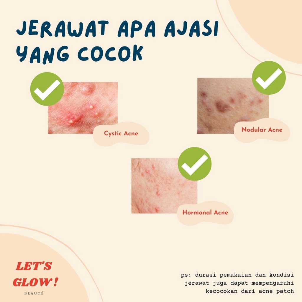 MICRONEEDLE ACNE PIMPLE PATCH PREMIUM MURAH