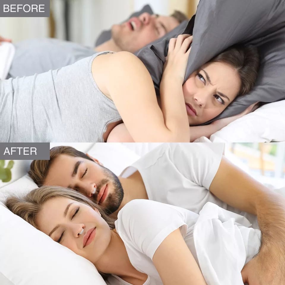 mrcaisen ALAT DENGKUR Alat Anti Ngorok Dengkur Pernafasan Hidung Stop Snoring Solution Magnetic A001