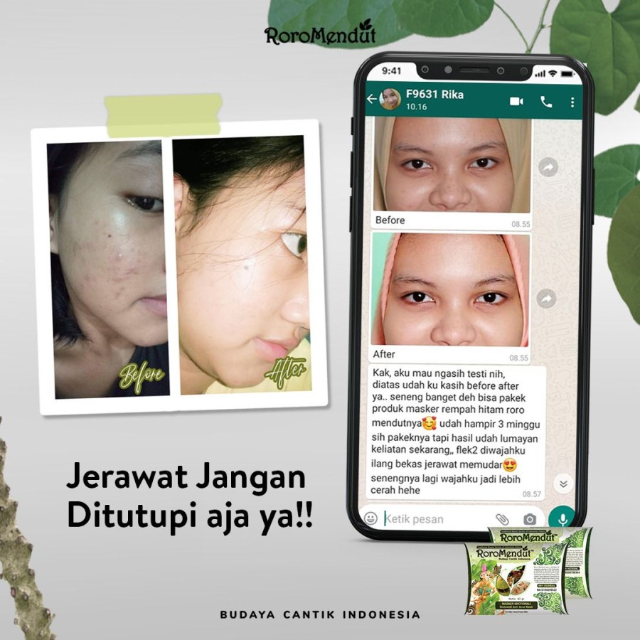 Masker Jerawat Premium Brotowali Roro mendut