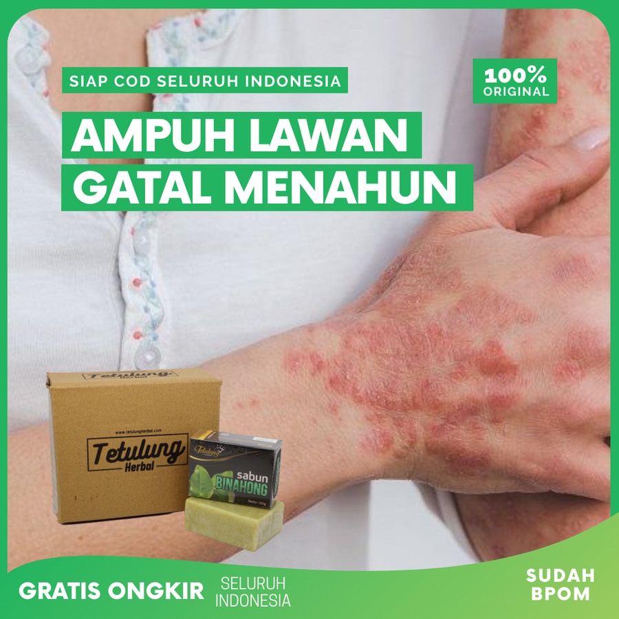 Sabun Binahong, Sabun Gatal Kulit Paling Ampuh, Sabun Gatal Eksim Ampuh, Sabun Panu Ampuh  Obat Gata