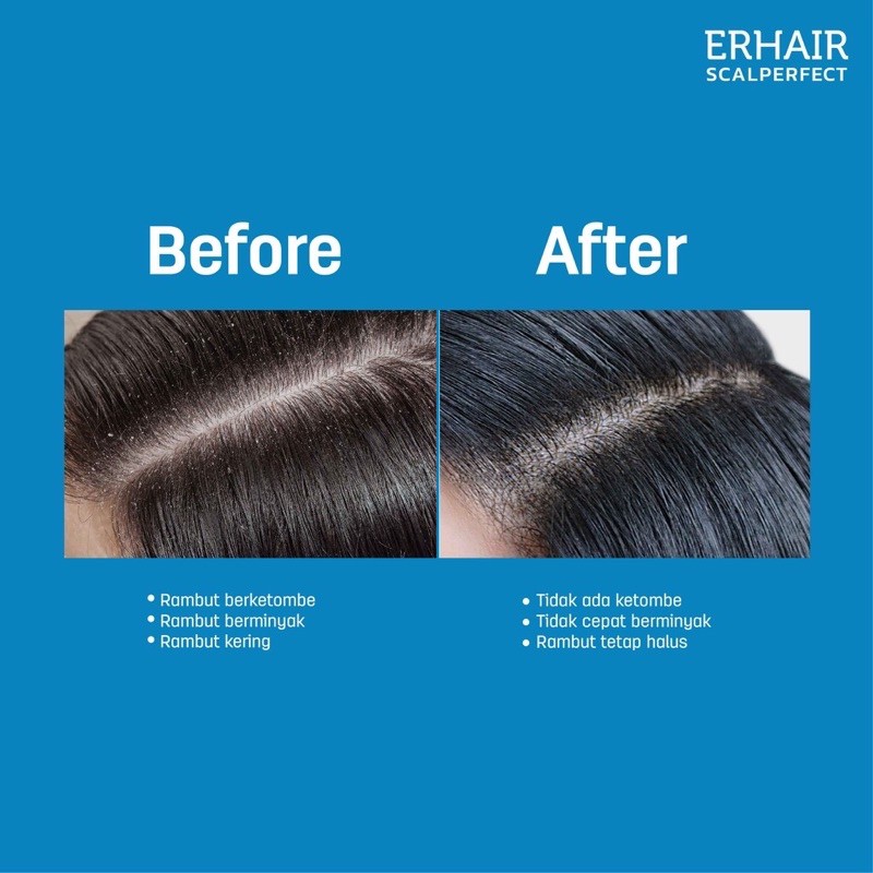 Erha Erhair Scalperfect Anti Dandruff Shampoo 100ml