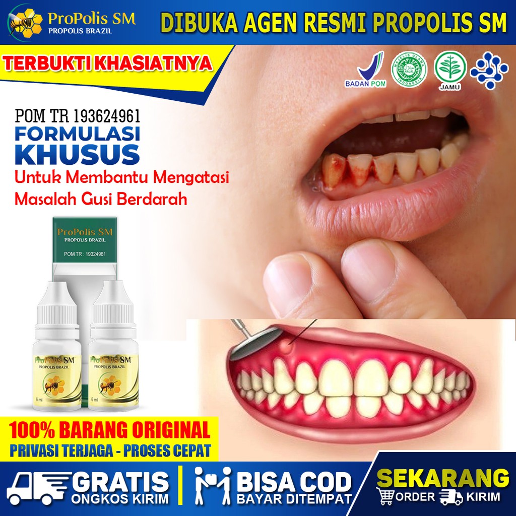 Jual Obat Gusi Berdarah - Gusi Bengkak - Benjolan Di Gusi - Obat Sakit ...