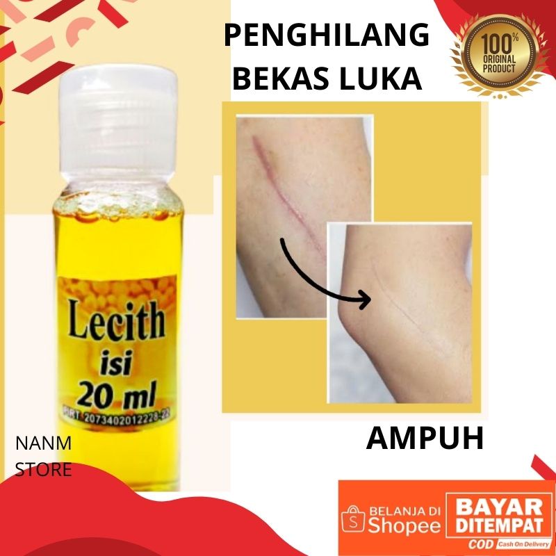 Lecith 20ml Original Obat Penghilang Bekas Luka Untuk Keloid Koreng Bekas Luka di wajah dan Gigitan