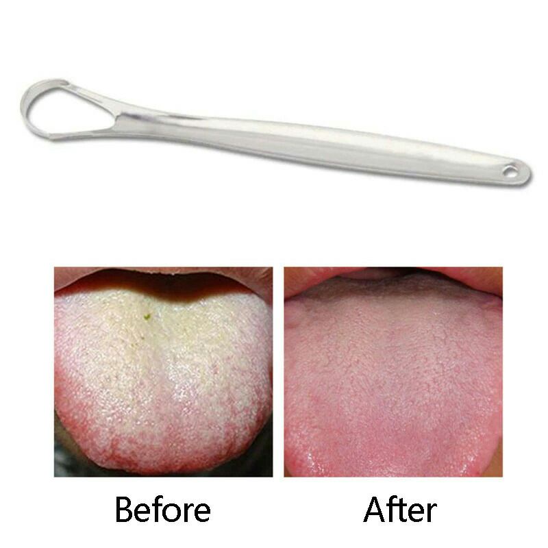 Pembersih Lidah Tongue Oral Scraper Cleaner FourSoft Lso134 Silver