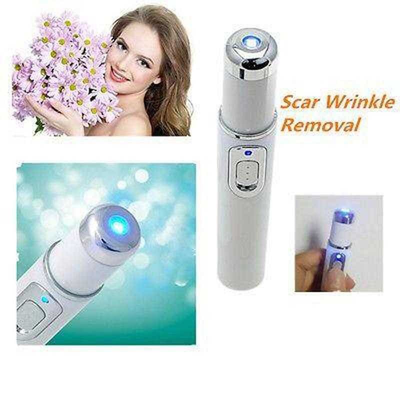 Pen LED Biru Laser Penghilang Jerawat Acne Treatment - KD-7910