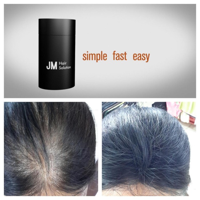 BAYAR DI TEMPAT JM Hair Solution