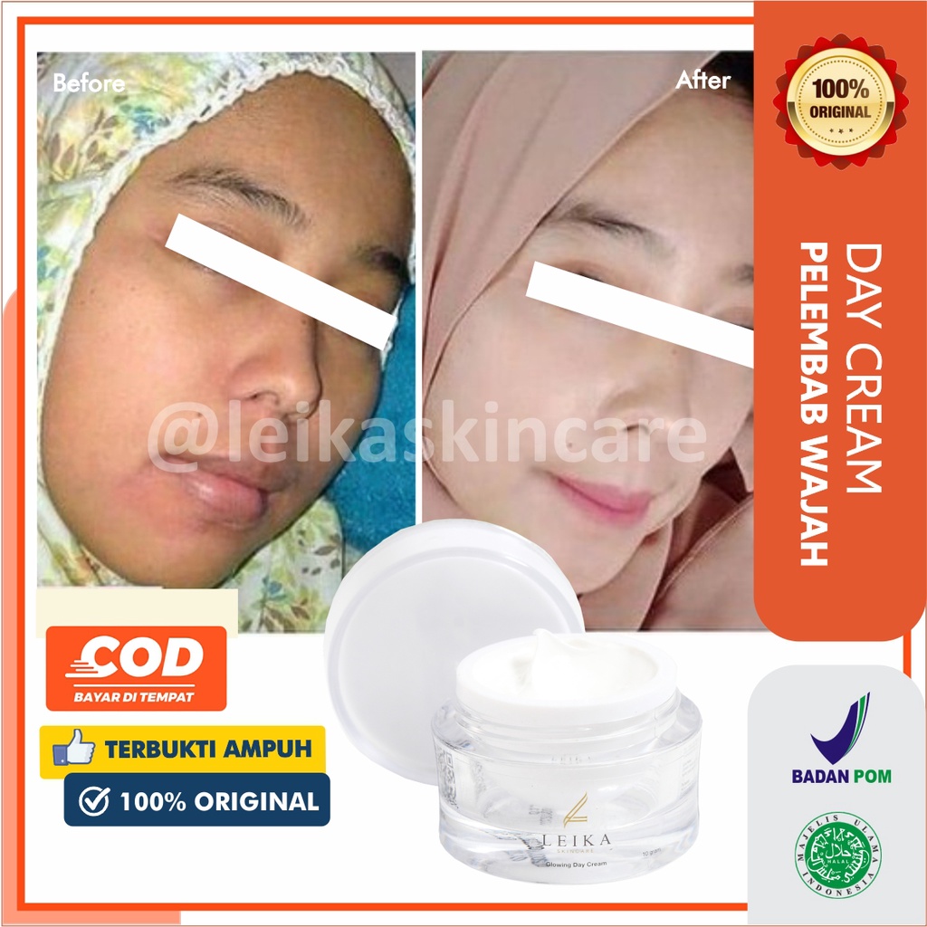 Menakjubkan! Krim Pelembab Wajah Kering dan Berminyak [Ampuh!] Cream Pelembab Wajah Jerawat jadi Glowing / Glowing Day Cream Leika Skincare 10gr Cream Pelembab Glowing Aman Ampuh Original BPOM Halal MUI