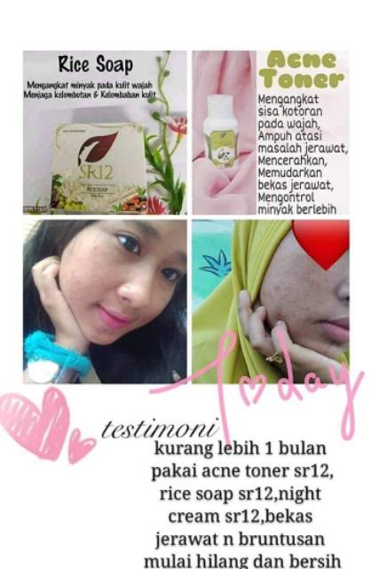 SABUN BERAS HERBAL SR12 TERLARIS..!! RICE SOAP / SABUN JERAWAT BPOM / KULIT BERMINYAK &amp; SENSITIF