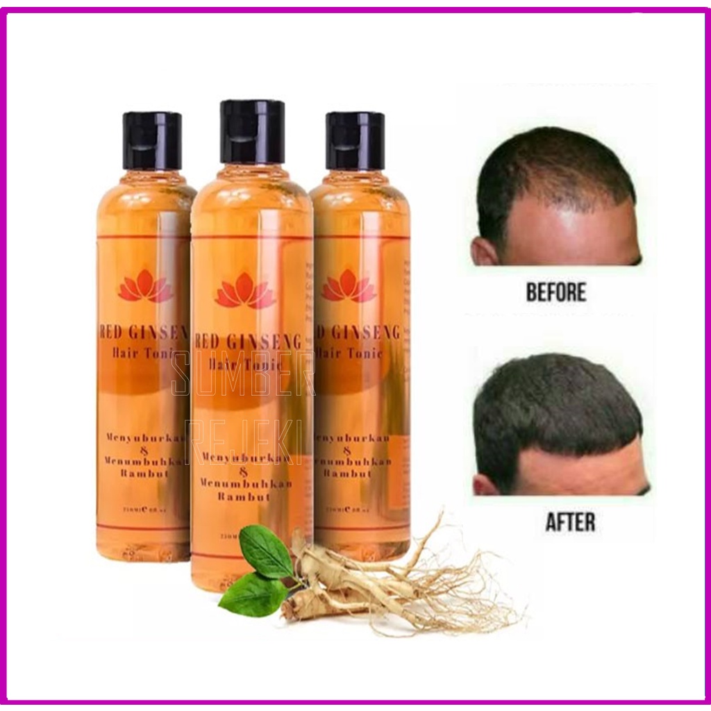 penumbuh rambut botak cepat alami pelebat dan penebal jenggot alis bulu mata Penumbuh Rambut Botak Alami Nutrisi Rambut Ori BPOM - Penyubur Rambut Rontok dan Perawatan Rambut PENUMBUH RAMBUT BOTAK PENUMBUH BREWOK PENUMBUH ALIS CEPAT OBAT KUAT PRIA-4