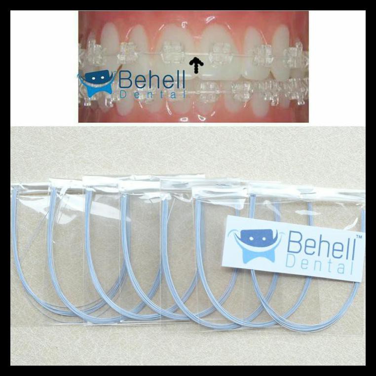 Kawat Niti Putih Behel Untuk Kawat Gigi Permanen | Ceramic | Transparan | Keramik