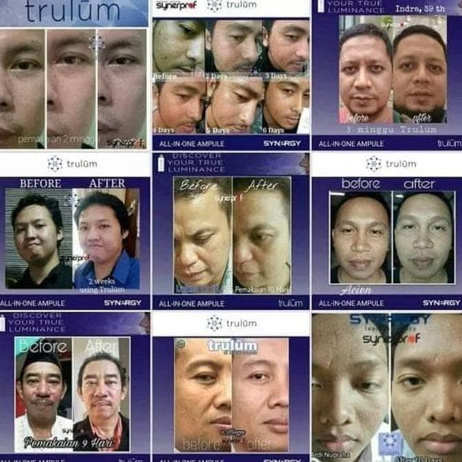 Perawatan Kulit Wajah Keriput | Trulum 5Ml/15Ml/120Ml \
