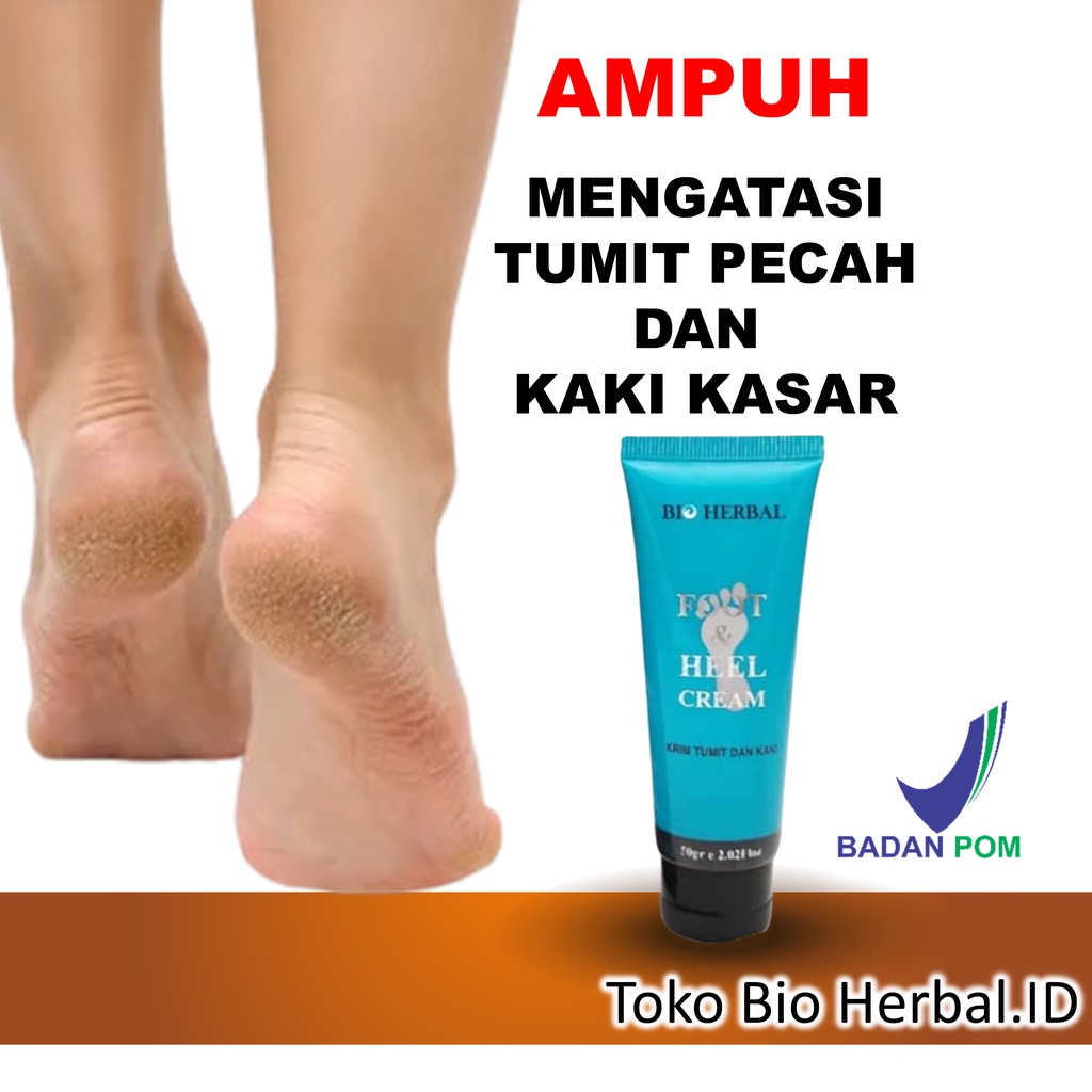 Obat Kaki Pecah Dan Kering Foot Cream Penghalus Tumit Kaki Cream Kaki Pecah2 B10P