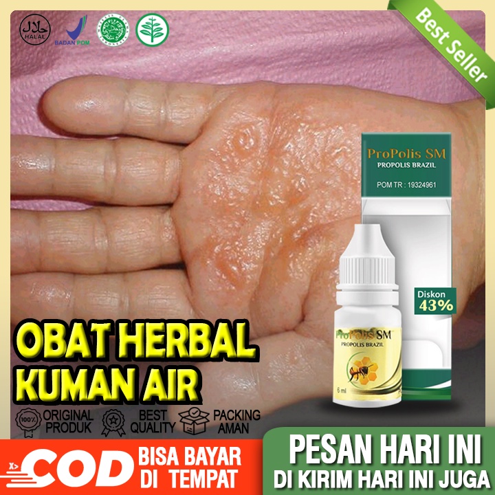 Obat Kuman Air