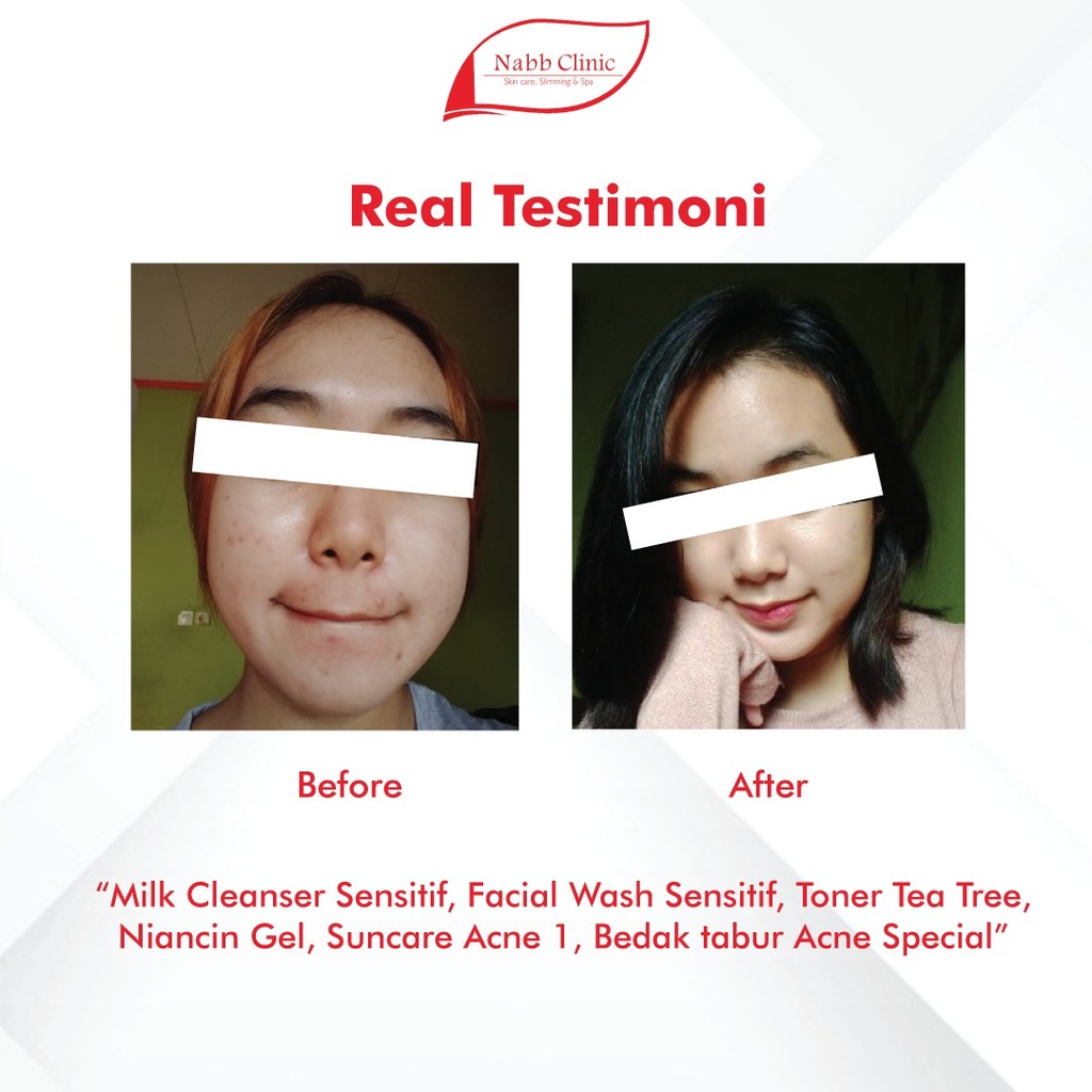 Facial Wash Sensitif