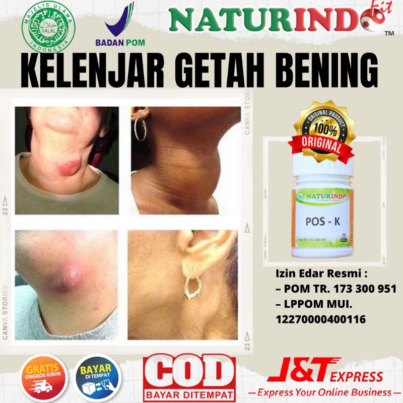 Obat Kelenjar Getah Bening Ampuh Kelenjar Tiroid Gondok Benjolan Di Leher Tangan Punggung Ketiak