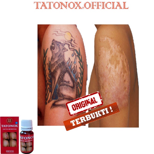 PENGHAPUS TATO PERMANEN ✅ PENGHILANG TATO TERBARU PENGHLIANG TATO AMPUH
