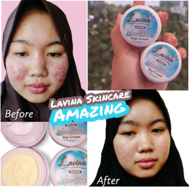 Lavina skincare
