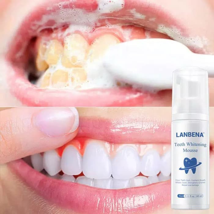 LANBENA Teeth Whitening Mousse Pemutih Gigi dan Membersihkan Noda Gigi