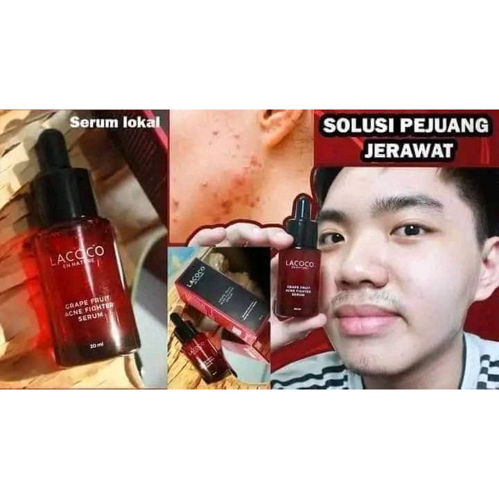 Nasa_serum untuk jerawat_Lacoco Grape Fruit Acne Fighter Serum_Aman_BPOM_halal_Asli original Nasa