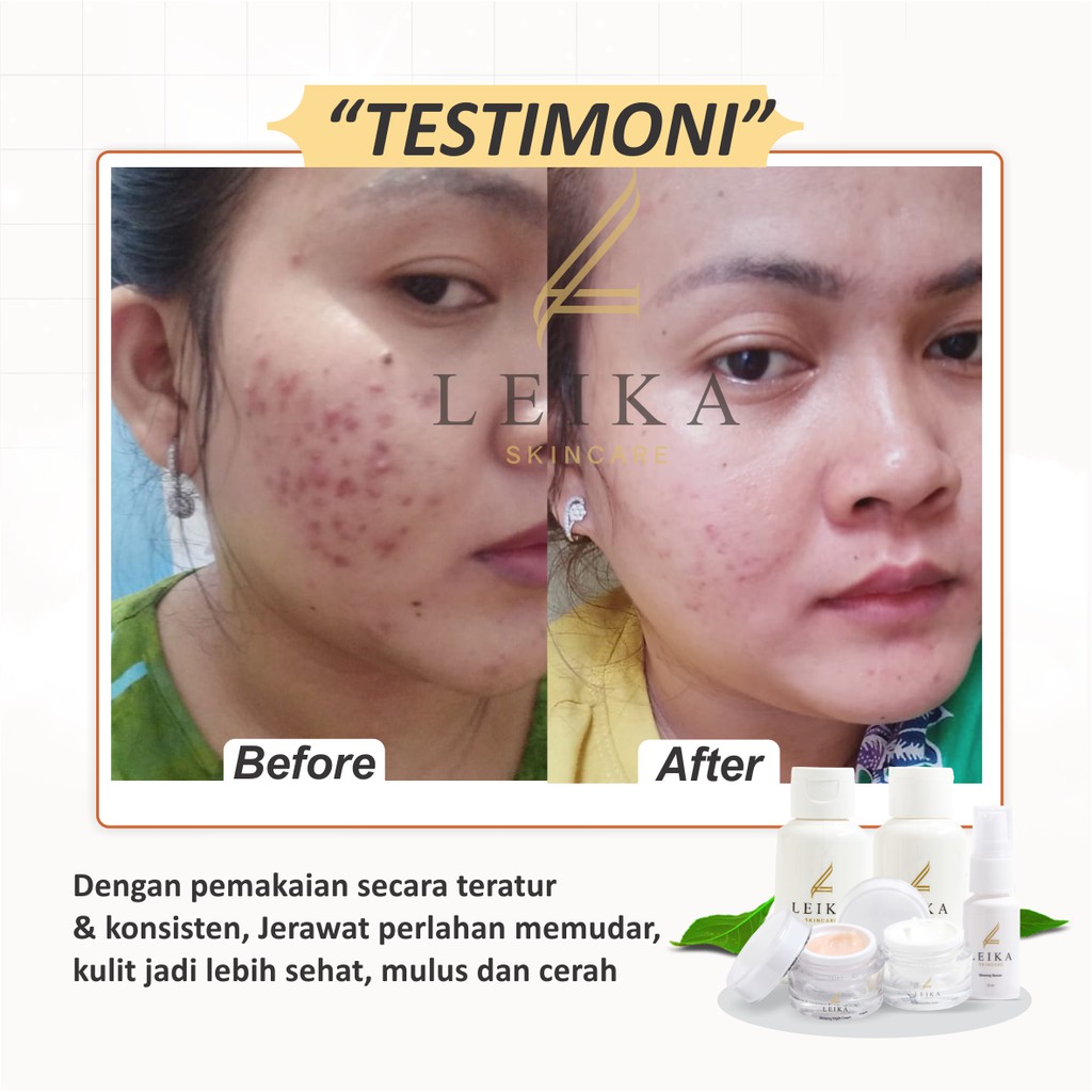 Leika Skincare Paket 5 in 1-2