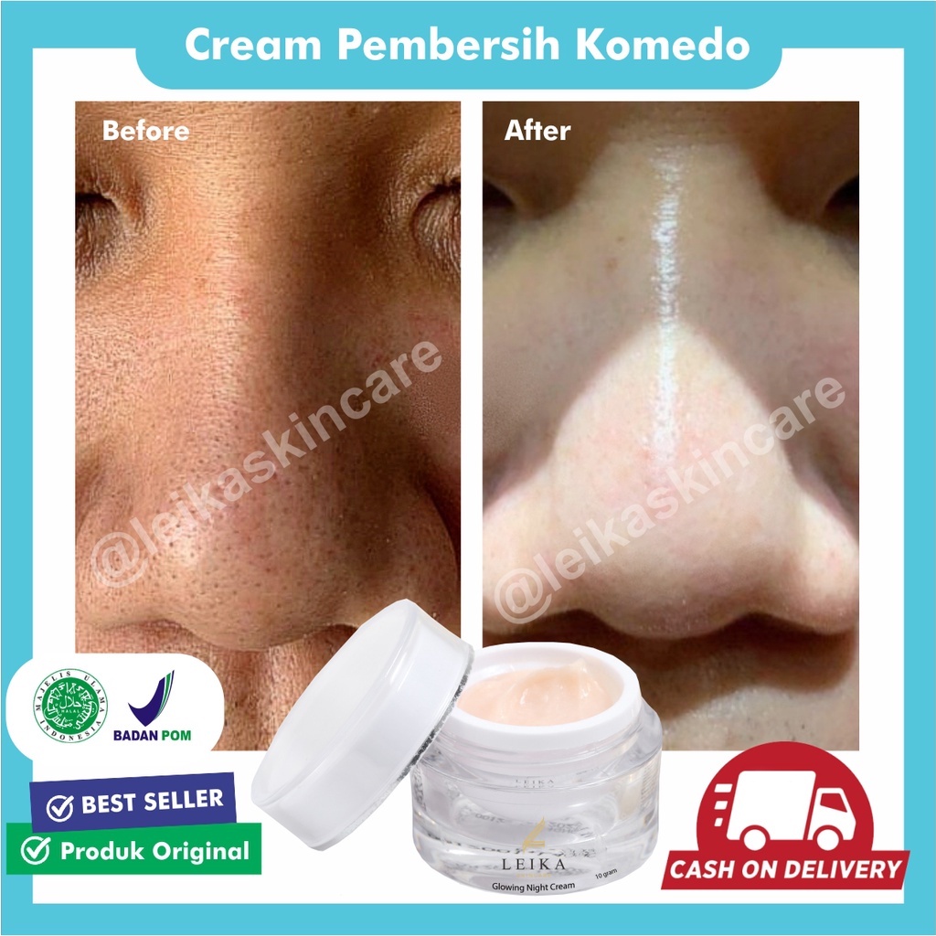 Pembersih Komedo Hidung BPOM Penghilang Komedo AMPUH Krim Komedo dan Pori Krim Malam Menghilangkan K