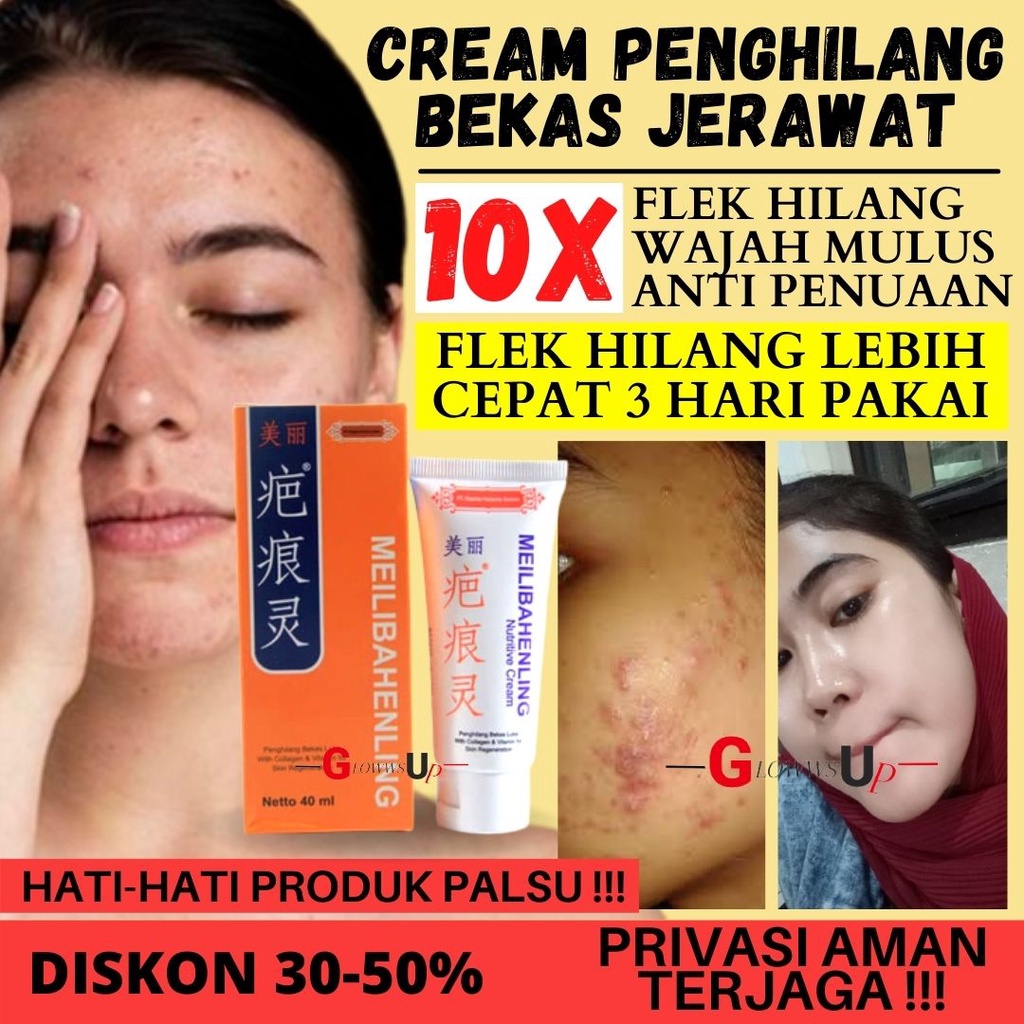 PENGHILANG BEKAS LUKA SALEP LUKA BAKAR MEILIBAHENLING NUTRIVE ORIGINAL BPOM