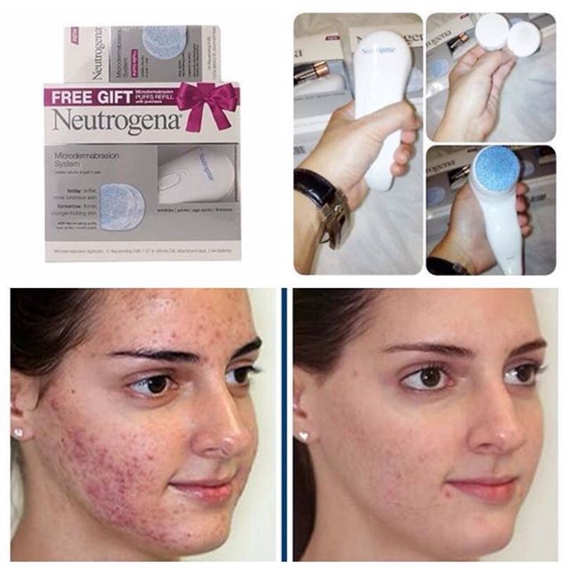 Neutrogena Microdermabrasion System