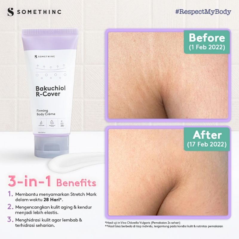 Somethinc Bakuchiol R-Cover Firming Body Crème - Krim Penghilang Stretch Mark