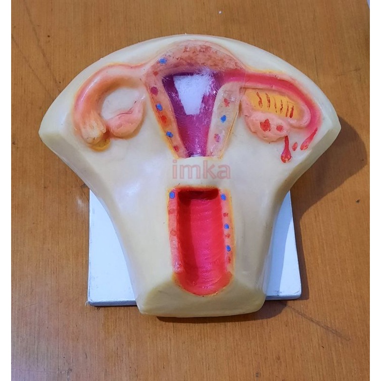 Alat Peraga Uterus Pemasangan dan Pengambilan IUD