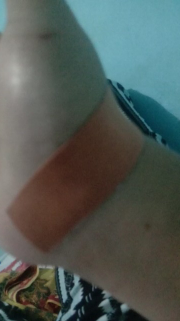 Teko Siul Bmw 5 Liter