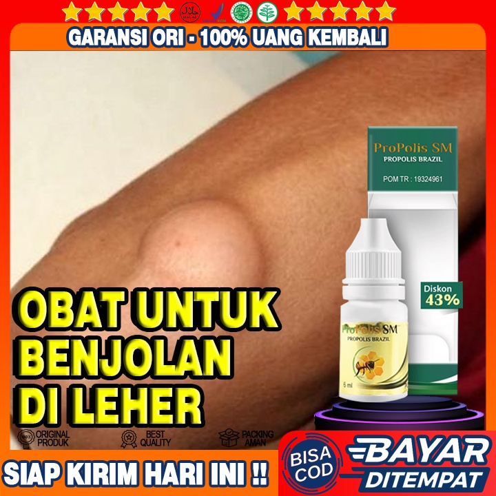 Obat Benjolan Lipoma, Kanker Kelenjar Getah Bening, Kelenjar Tiroid, Benjolan Leher, Benjolan Dahi, 