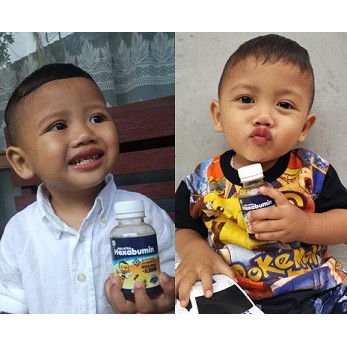 Hexabumin Suplement vitamin Nutrisi untuk Anak Lengkap- Meningkatkan Daya Tahan Tubuh Anak