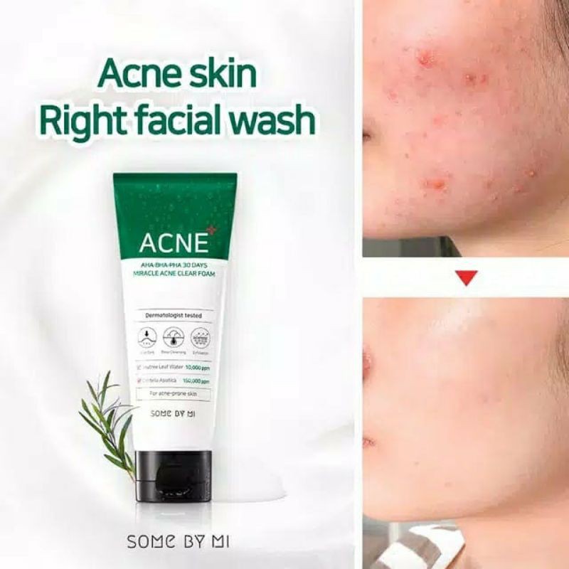 SOMEBYMI 30 Days Miracle Acne Clear Foam 100ml