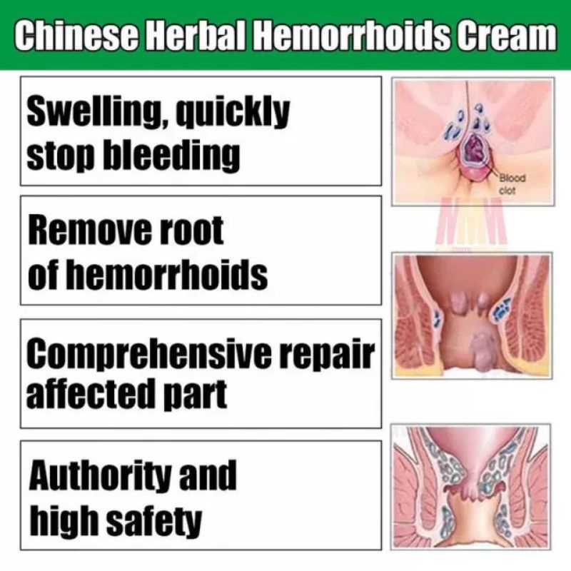 SALEP OBAT WASIR AMBEYEN AMBEIEN AMPUH HERBAL CINA SALAP SALEP DICTAMNI BERKHASIAT AMAN