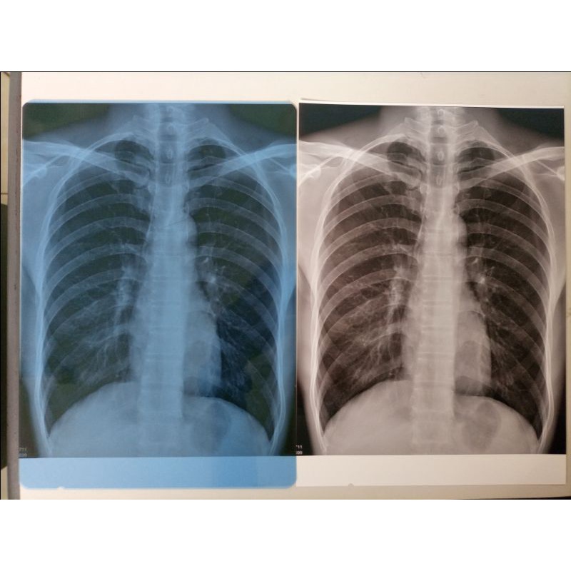 Film Xray Inkjet Blue (Biru) / White (Putih)