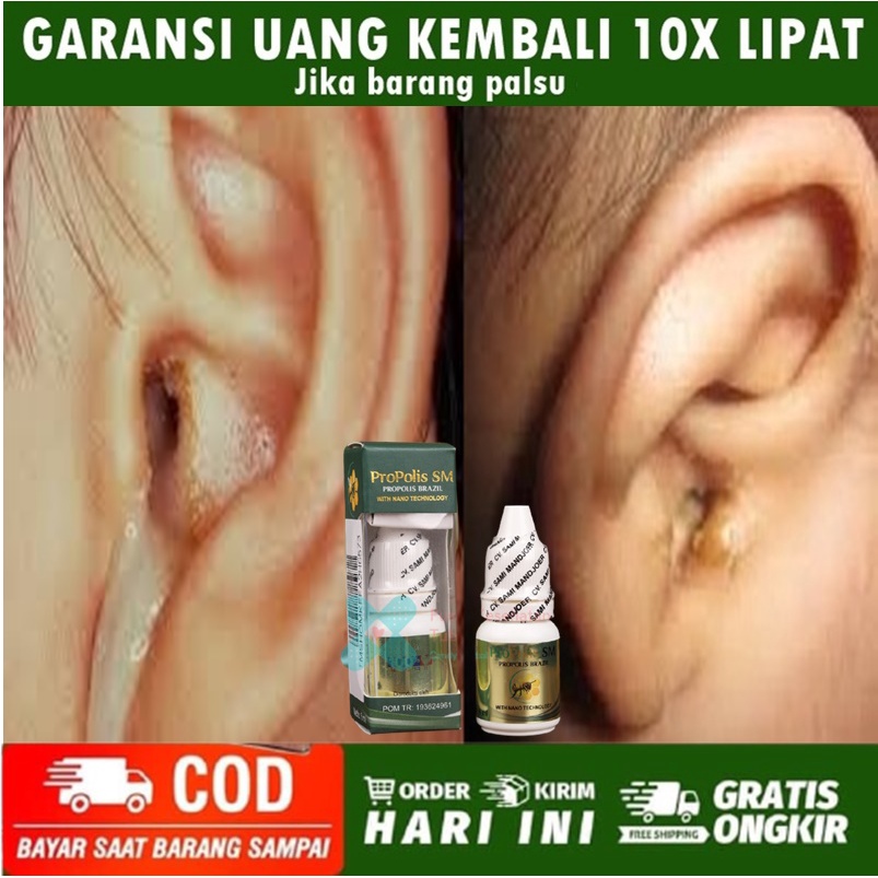 Obat telinga bernanah, Obat congek, propolis, Obat telinga sakit, Obat tetes telinga bernanah, tetes