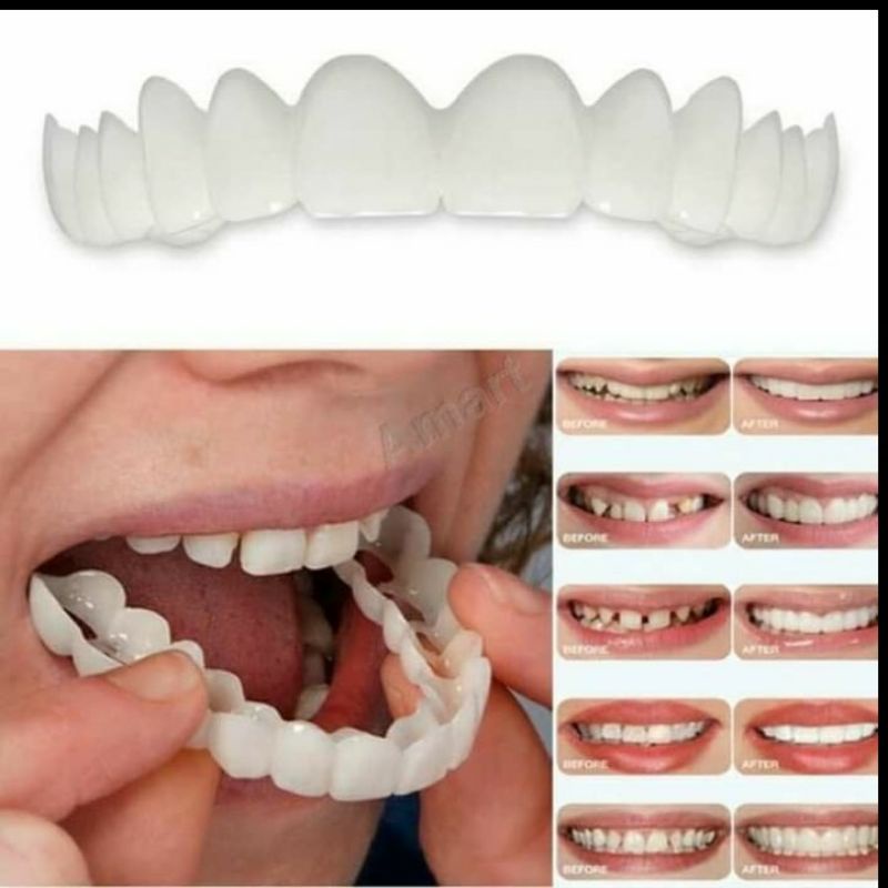 [COD] SNAP ON SMILE GIGI PALSU SEPASANG