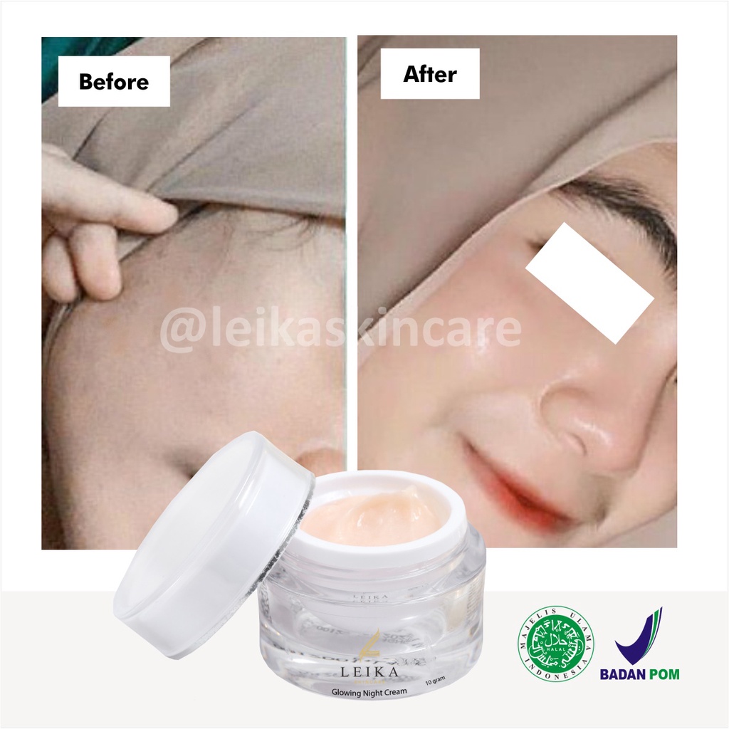 Ampuh! Pelembab Wajah Bikin Kulit Wajah Glowing dan Putih Krim Pelembab Wajah Kering Berjerawat Ampuh Glowing Night Cream Leika Skincare Cream Wajah Glowing Aman BPOM Krim Pe mutih Wajah bpom Glowing Cream Pe mutih Wajah Glowing  BPOM Asli 100% HALAL MUI