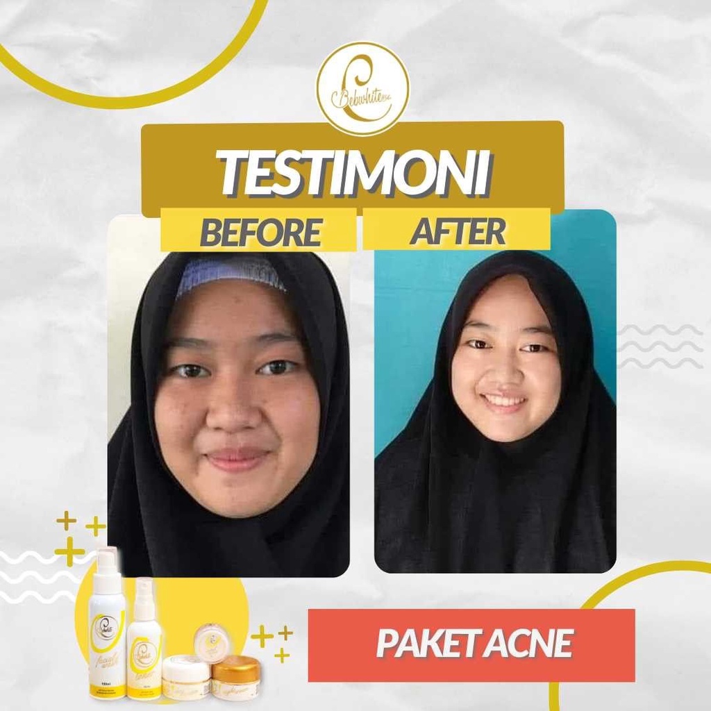 BEBWHITE C BBC BBWHITE GLOW ACNE DAYCREAM TOTOL JERAWAT PERAWATAN WAJAH BERMINYAK