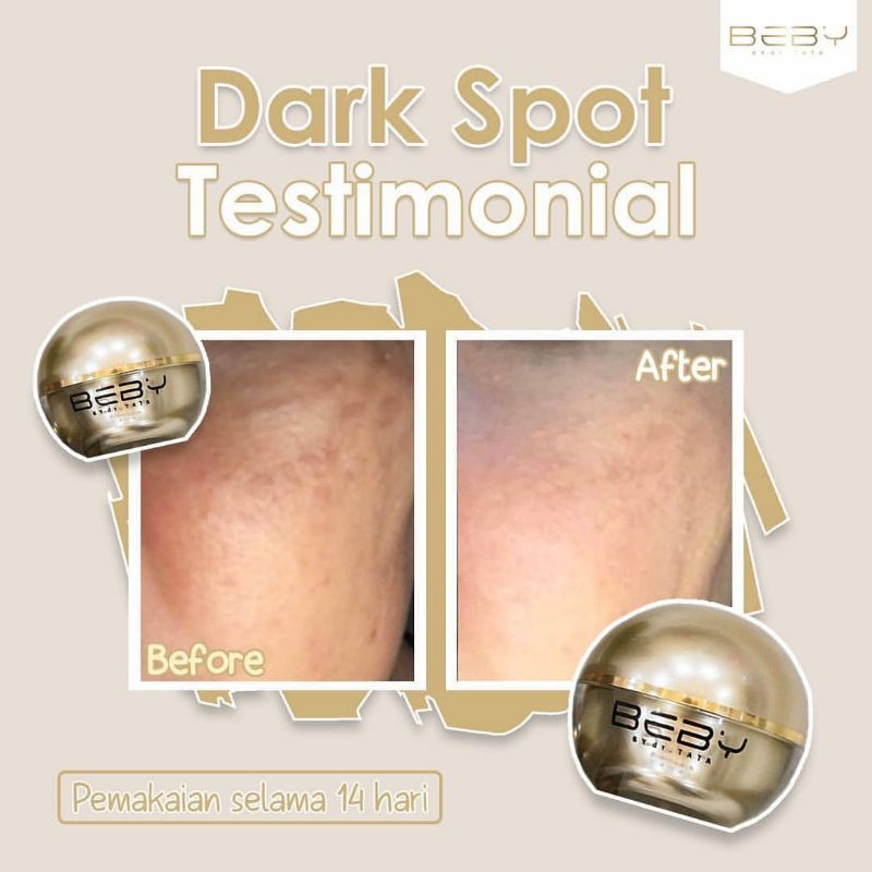 PROMO MURAH DARK SPOT( ANTI FLEK)