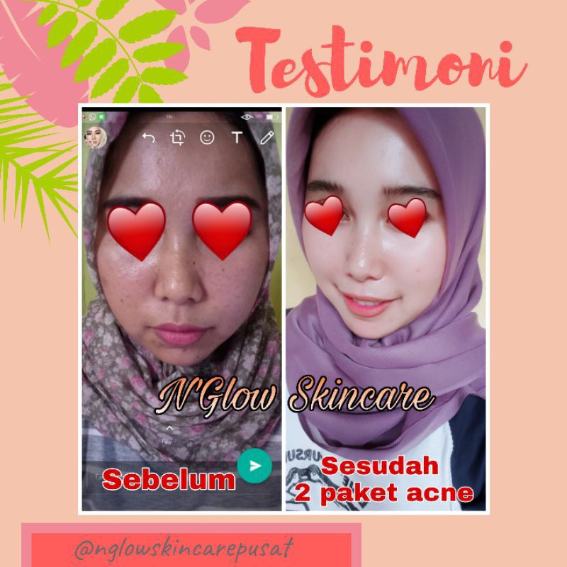 N'glow skincare 100% original BPOM
