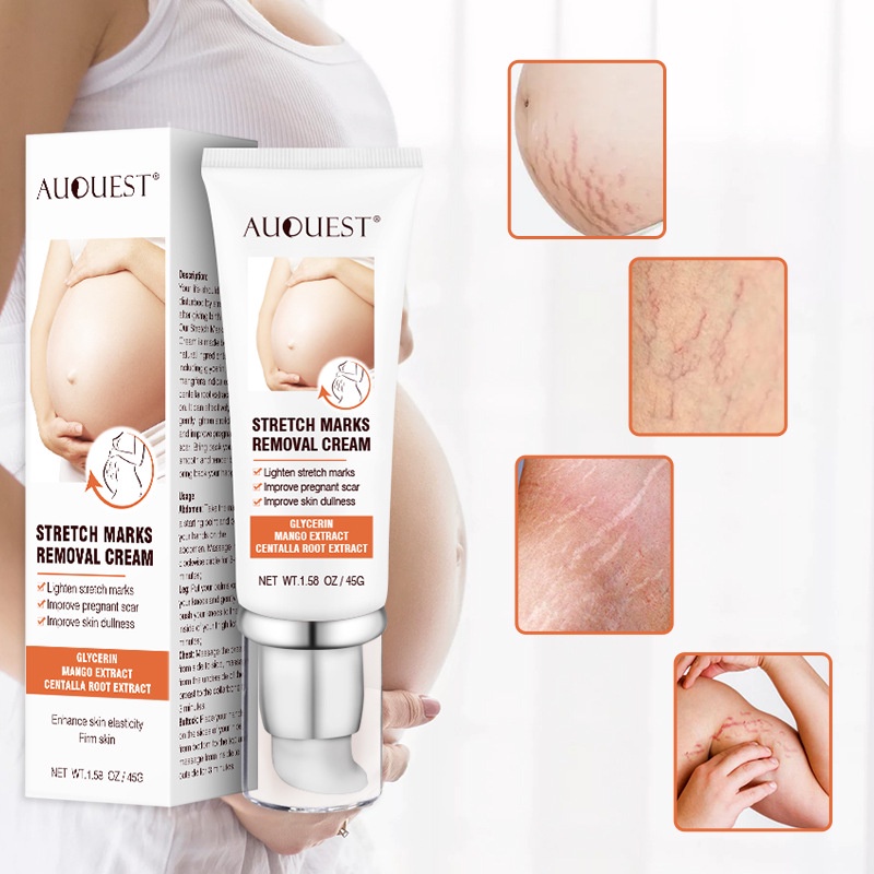 AUQUEST hamil perut tato krim perut firming cream memudar postpartum obesitas stretch mark perbaikan cream